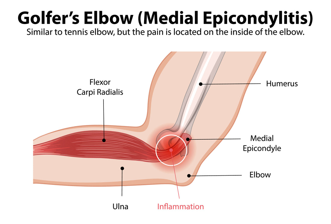 tendon inflammation